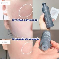 Dung Dịch Tẩy Da Chết Paula’s Choice Skin Perfecting 2% BHA Liquid