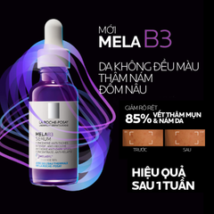 Tinh Chất Giảm Thâm Nám Dưỡng Sáng Da La Roche-Posay Mela B3 Serum 30ml