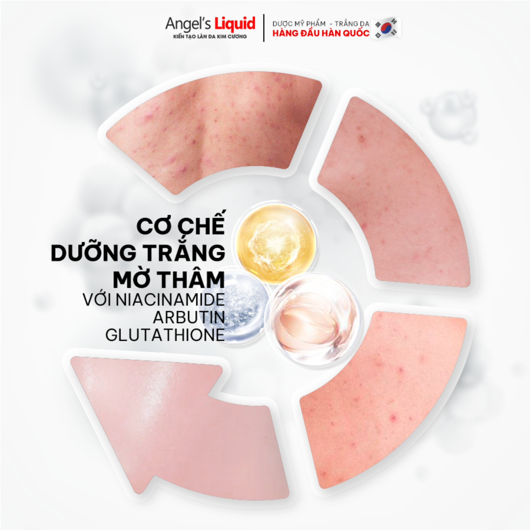 glutathione spot care body mist Xịt mụn lưng Angel Liquid Glutathione Spot Care Body Mist 150ml main image 0