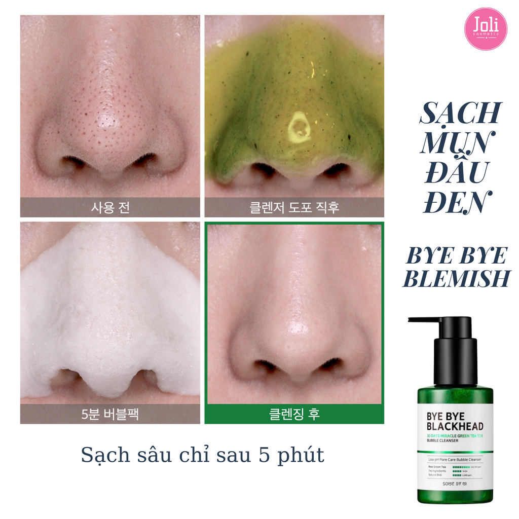 Sữa Rửa Mặt Some By Mi Sủi Bọt Làm Giảm Mụn Đầu Đen 120ml Bye Bye Blackhead 30 Days Miracle Green Tea Tox Bubble Cleanser