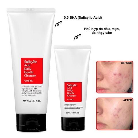 Sữa Rửa Mặt Cosrx Cho Da Dầu Mụn Salicylic Acid Daily Gentle Cleanser