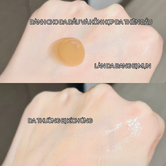 Kem Dưỡng Làm Dịu Phục Hồi Da Skin1004 Madagascar Centella Soothing Cream