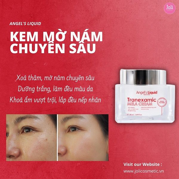 Kem Dưỡng Mờ Nám Chuyên Sâu Angel's Liquid Tranexamic Mela Cream 50ml