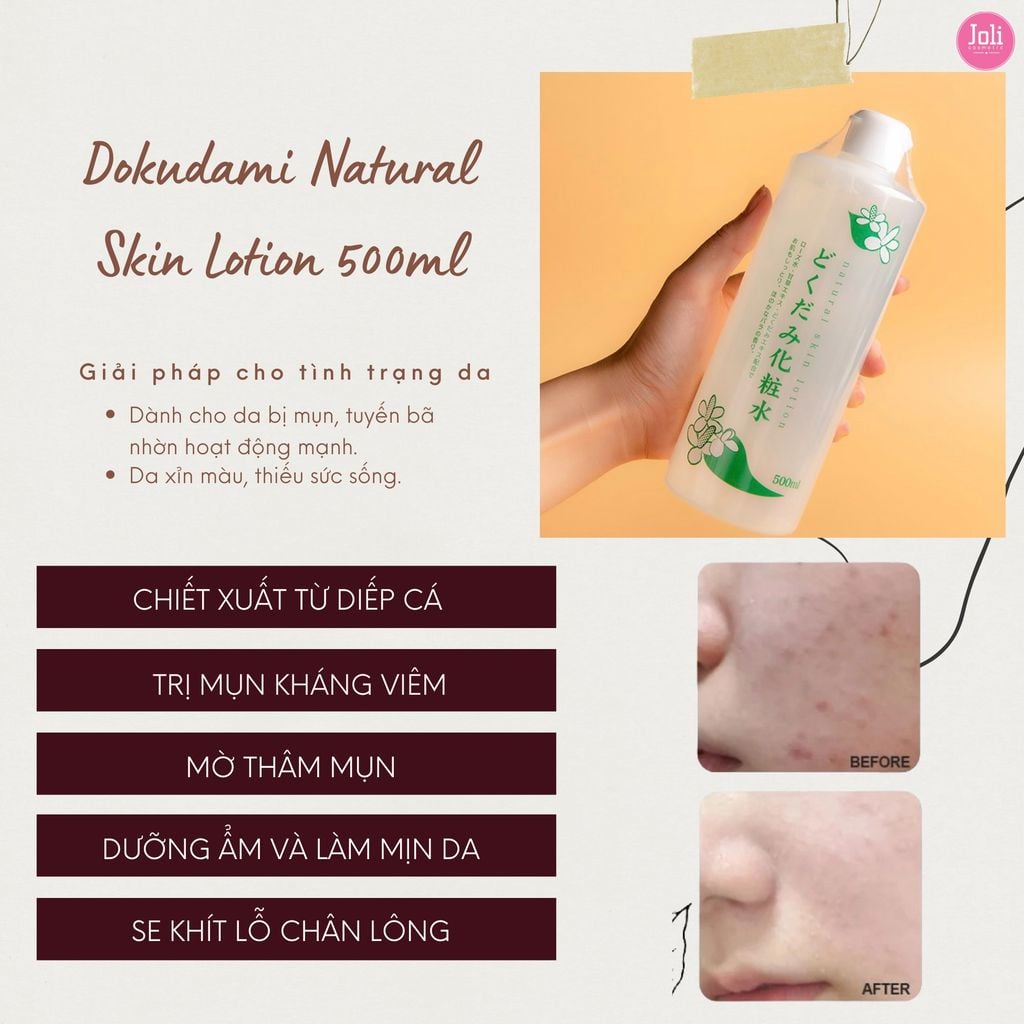 Nước Hoa Hồng Chiết Xuất Từ Lá Diếp Cá Dokudami Natural Skin Lotion 500ml