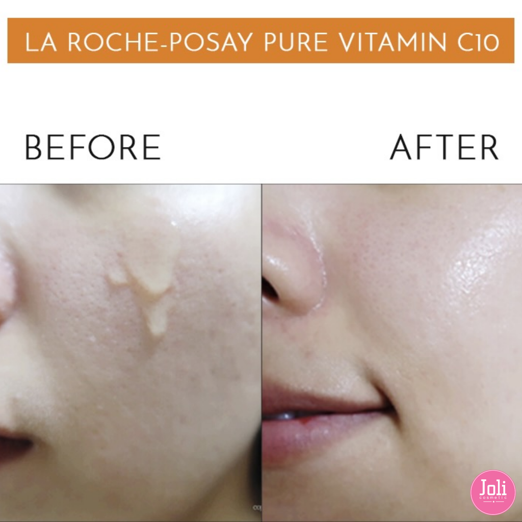 Tinh Chất Làm Sáng Da Và Giảm Thâm Nám La Roche-Posay Redermic Pure Vitamin C10 Serum 30ml