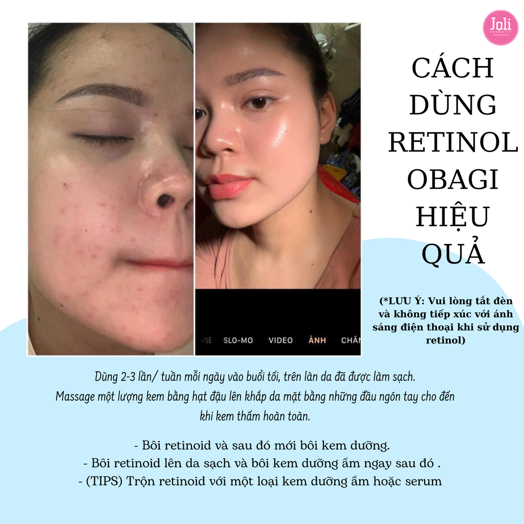 Kem Dưỡng Chống Lão Hóa Da Ngừa Mụn Obagi Retinol 1.0 Cream