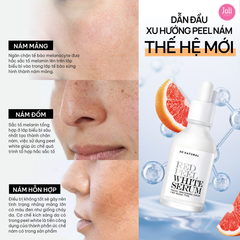 Tinh Chất Dưỡng Trắng Làm Đều Màu Da So Natural Red Peel White Serum
