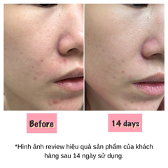 Tinh Chất Dưỡng Ẩm Làm Dịu Cho Da Nhạy Cảm Bioderma Sensibio Defensive Serum 30ml