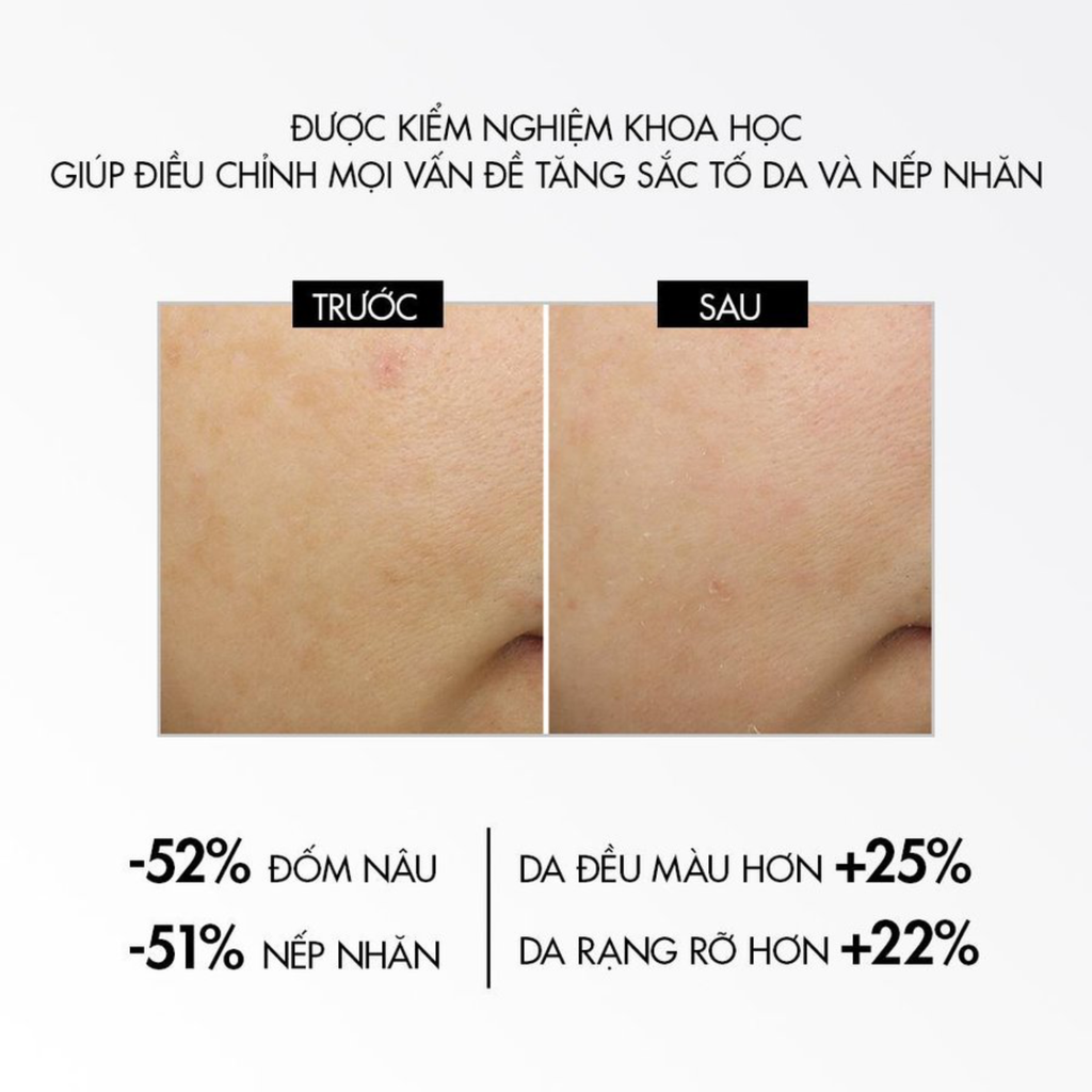 Kem Dưỡng Mờ Nám Dưỡng Sáng Da Ban Đêm Vichy Liftactiv B3 Pure Retinol Cream Night 50ml