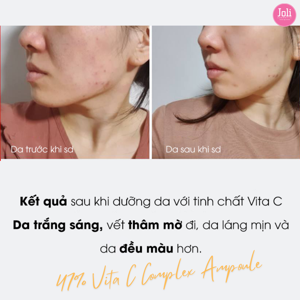 Tinh Chất Dưỡng Trắng Mờ Thâm Nám Histolab 47 Vita C Complex Ampoule Derma Science 50ml