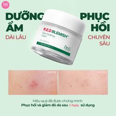 Bộ Chăm Sóc Da Dr.G R.E.D Blemish Clear Soothing Cream Bonus Set