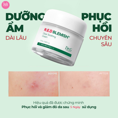 Bộ Chăm Sóc Da Dr.g R.E.D Blemish Clear Soothing Cream Bonus Set