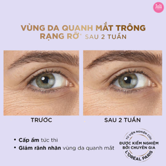 Tinh Chất Giảm Bọng Mắt & Làm Đầy Rãnh Nhăn Loreal Revitalift 2.5% Hyaluronic Acid + Caffeine Eye Serum 20ml