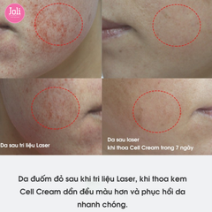 Kem Dưỡng Ẩm Phục Hồi Da Sau Laser Post Care Histolab Cell Cream 50ml