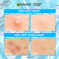 Gel Rửa Mặt Cho Da Dầu Mụn Garnier Bright Complete Anti-Acne Cleansing Gel 120ml
