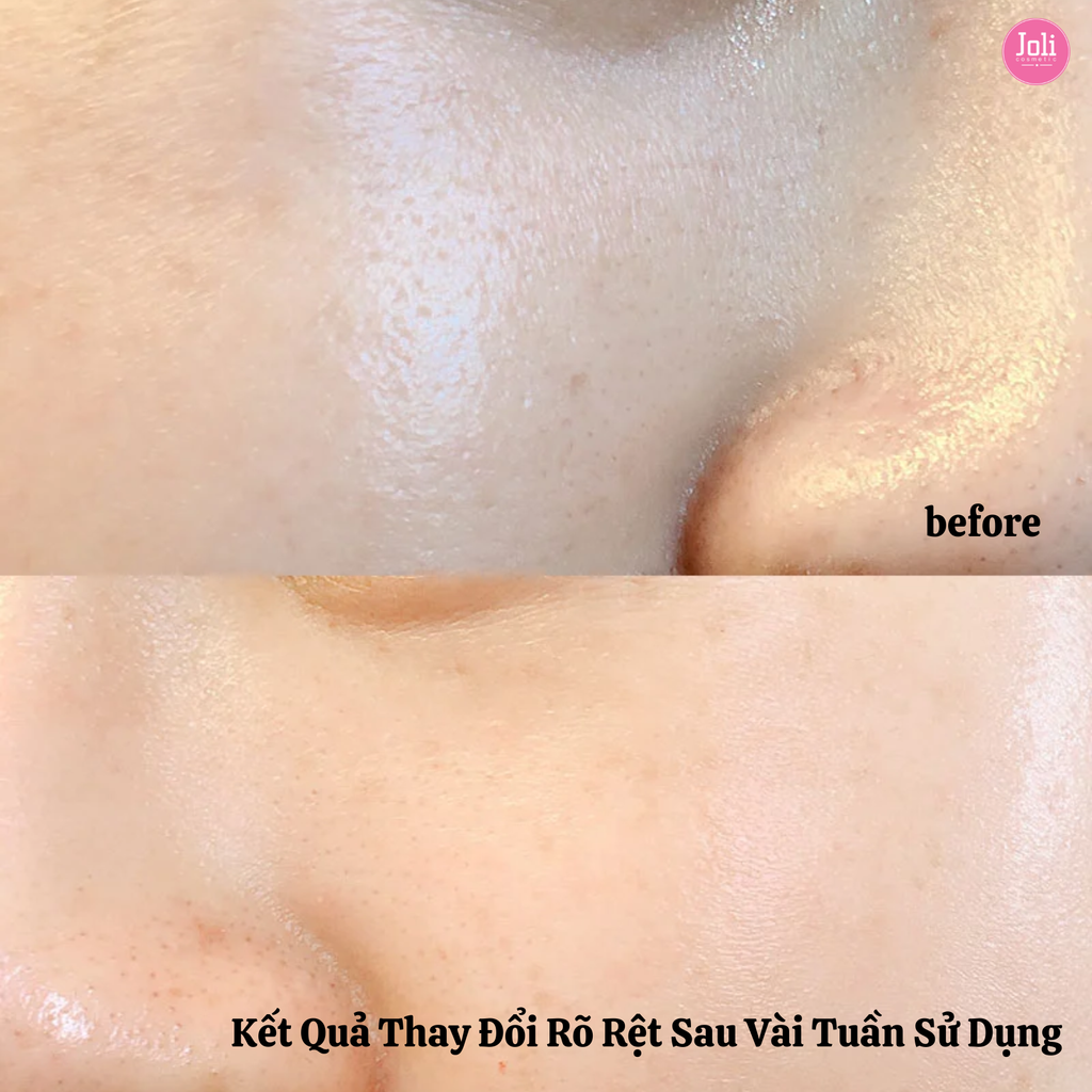 Tinh Chất Se Khít Lỗ Chân Lông Paula's Choice Clinical Niacinamide 20% Treatment 20ml