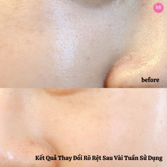 Tinh Chất Se Khít Lỗ Chân Lông Paula's Choice Clinical Niacinamide 20% Treatment 20ml