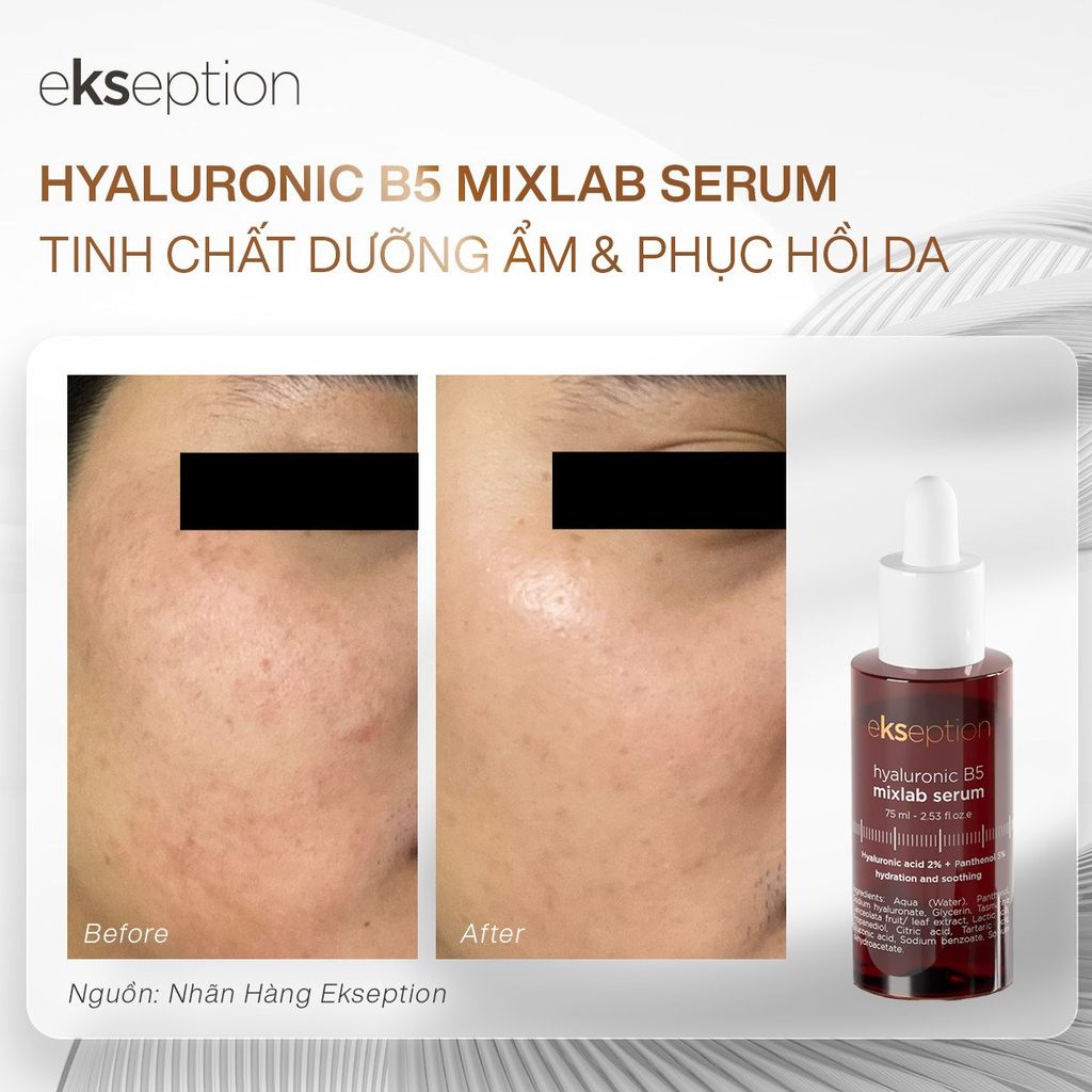 Tinh Chất Dưỡng Ẩm Làm Dịu Da Ekseption Hyaluronic B5 Mixlab Serum 75ml