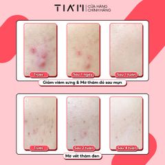 Kem Chấm Mụn Giảm Mụn Mờ Thâm Liền Sẹo Tia'm AC Fighting Spot RX Cream 30g