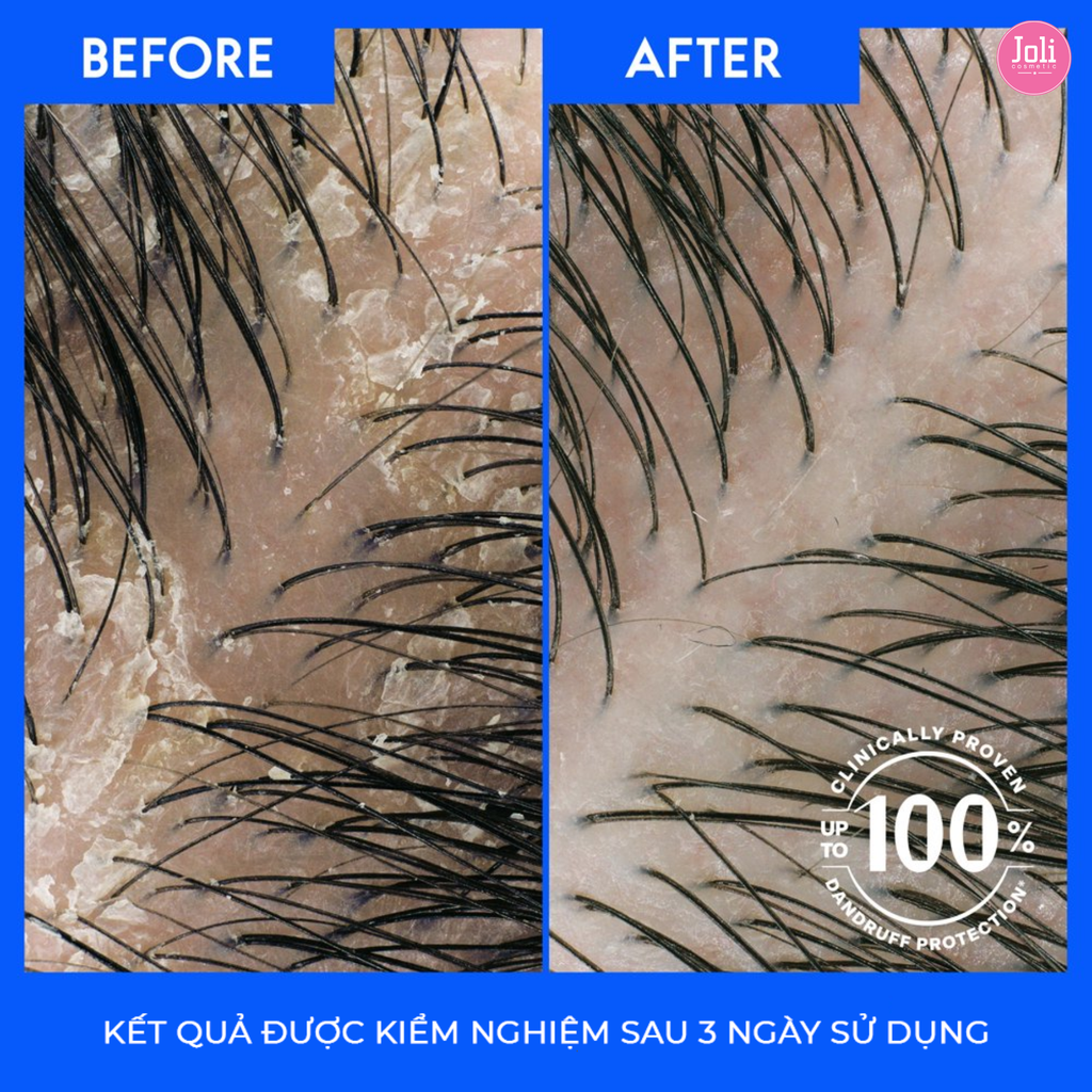 Dầu Gội & Xả Suôn Mềm Óng Mượt Head & Shoulders Pyrithione Zinz Dandruff Smooth & Silky 2in1 370ml