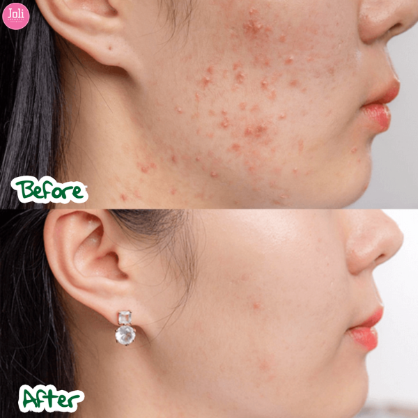 Kem Dưỡng Tái Tạo & Phục Hồi Da Nhạy Cảm MartiDerm Skin Repair Cicra Vass Cream 30ml
