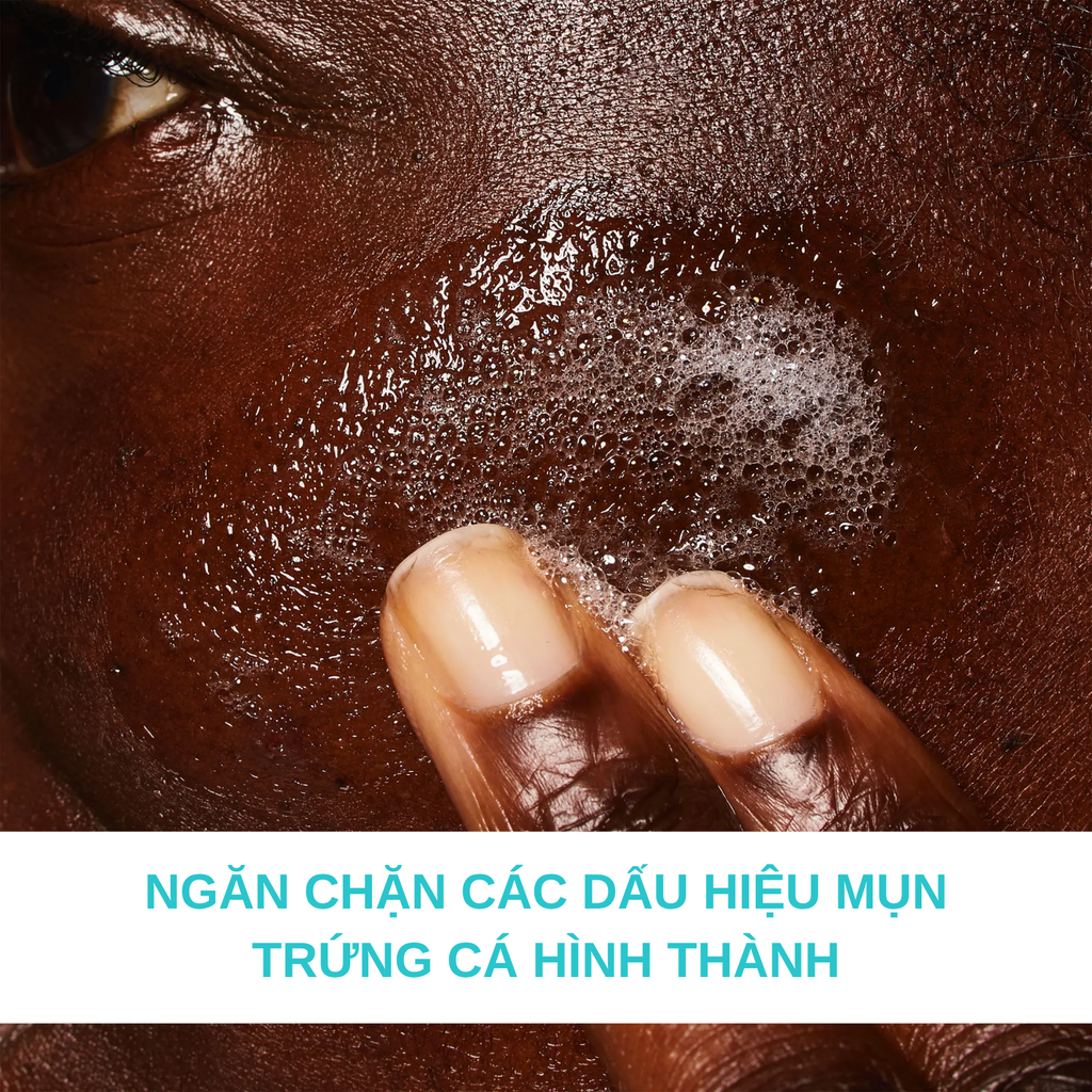 Sữa Rửa Mặt Giảm Mụn Cerave Blemish Control Cleanser