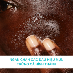 Sữa Rửa Mặt Giảm Mụn Cerave Blemish Control Cleanser