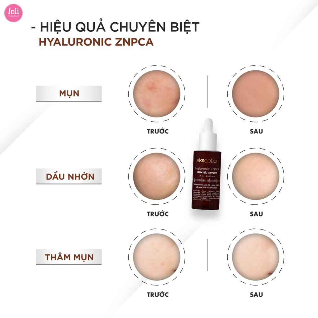 Tinh Chất Giảm Mụn Kiềm Dầu Ekseption Hyaluronic ZnPCA Mixlab Serum 75ml