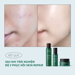 Tinh Chất Phục Hồi Tái Tạo Cấp Ẩm Da Caryophy Skin Repair Serum 50ml