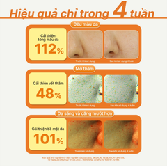 Tinh Chất Dưỡng Sáng Da innisfree Vitamin C Green Tea Enzyme Brightening Serum