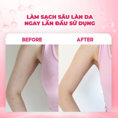 Tẩy Da Chết Body Muối Hồng Rmon White Label Dia Body Scurb 200g