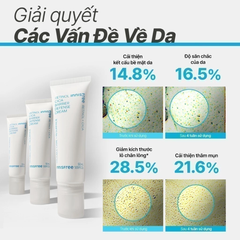 Bộ Dưỡng Ẩm innisfree Retinol Cica All Care Kit