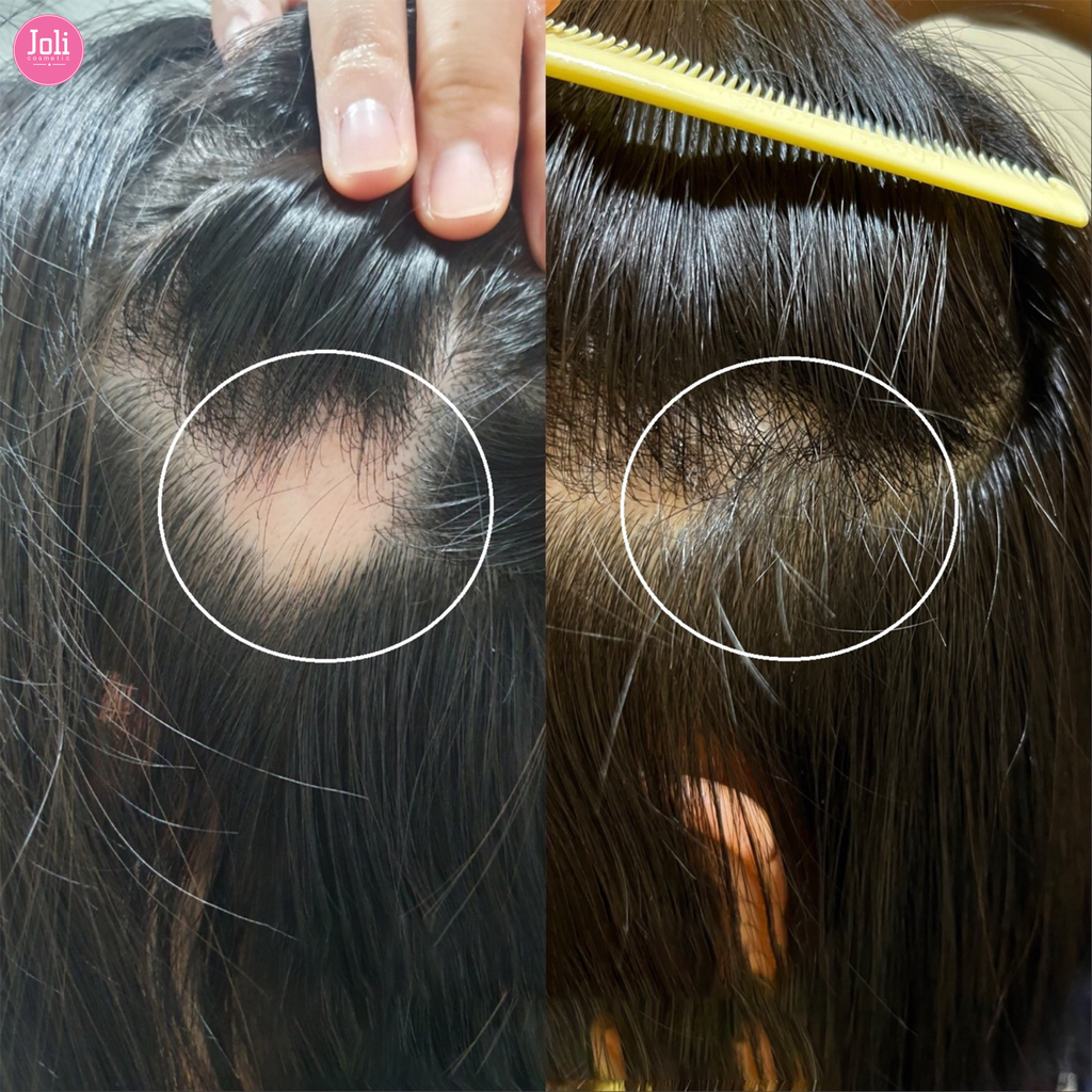 Dầu Xả Dưỡng Tóc Suôn Mượt Dr.FORHAIR Folligen Scalp Pack 250ml