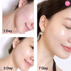 Kem Dưỡng Chống Lão Hóa Ban Ngày Olay Total Effects 7in1 Day Moisturiser Nourish & Protect SPF30 50ml