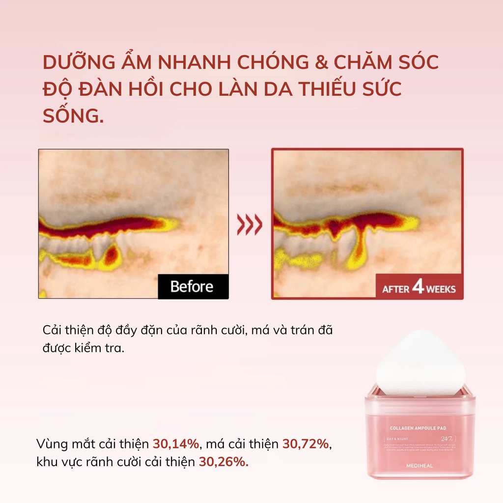 Nước Hoa Hồng Dạng Miếng Mediheal Toner Pad 170ml