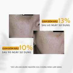 Kem Chống Nắng Cho Mọi Loại Da Heliocare 360 Pigment Solution Fluid SPF50+ PA++++ 50ml