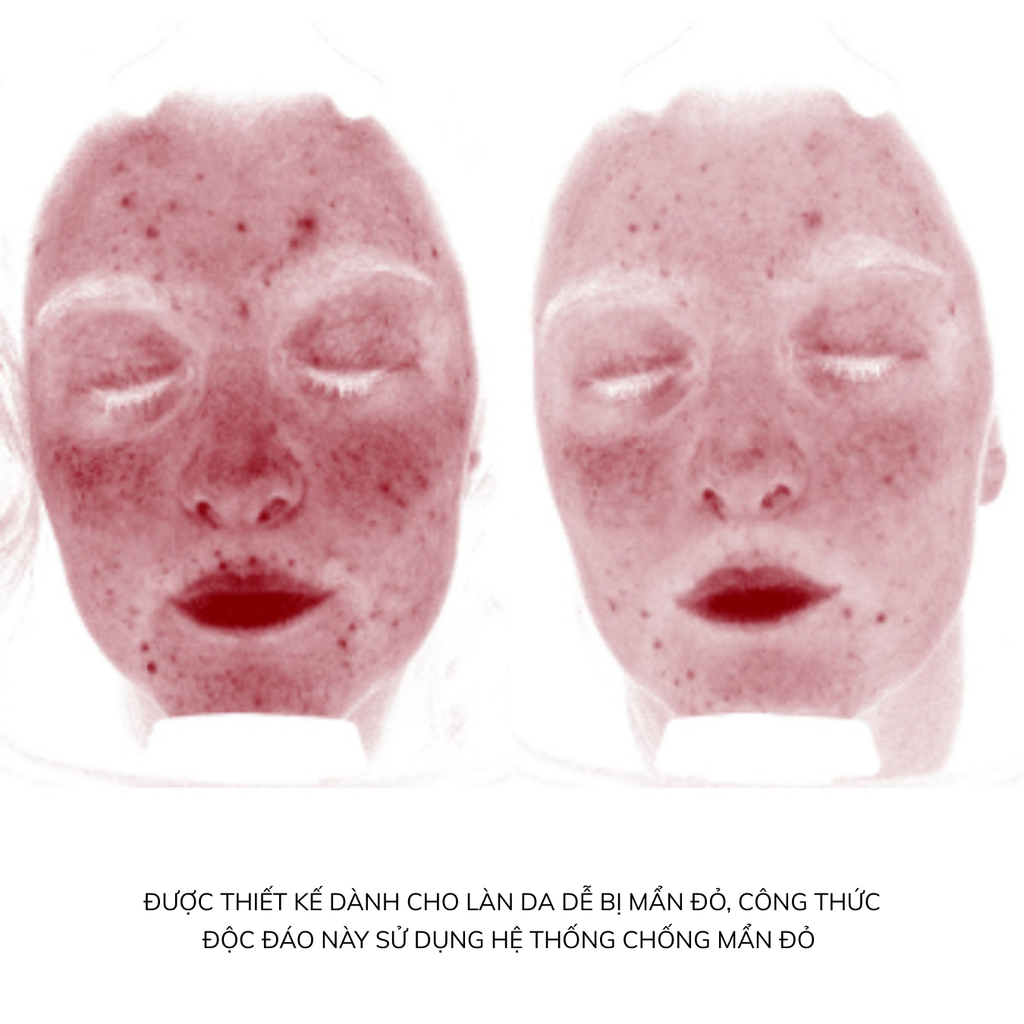 Kem Chống Nắng Cho Da Nhạy Cảm Heliocare 360 MD A-R Emulsion SPF50+ PA++++ 50ml