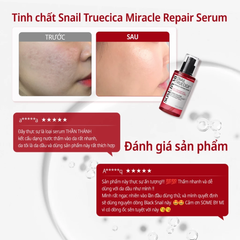 Tinh Chất Phục Hồi Da Mờ Thâm Sẹo Some By Mi Snail Truecica Miracle Repair Serum 50ml
