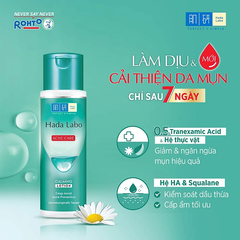 Lotion Dưỡng Ẩm Cho Da Mụn Và Nhạy Cảm Hada Labo Acne Care Calming Lotion 170ml