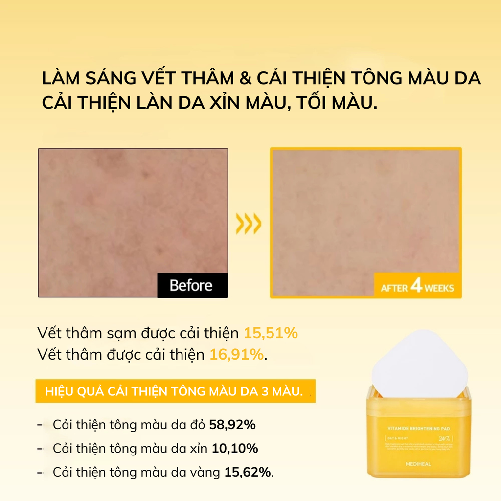 Nước Hoa Hồng Dạng Miếng Mediheal Toner Pad 170ml