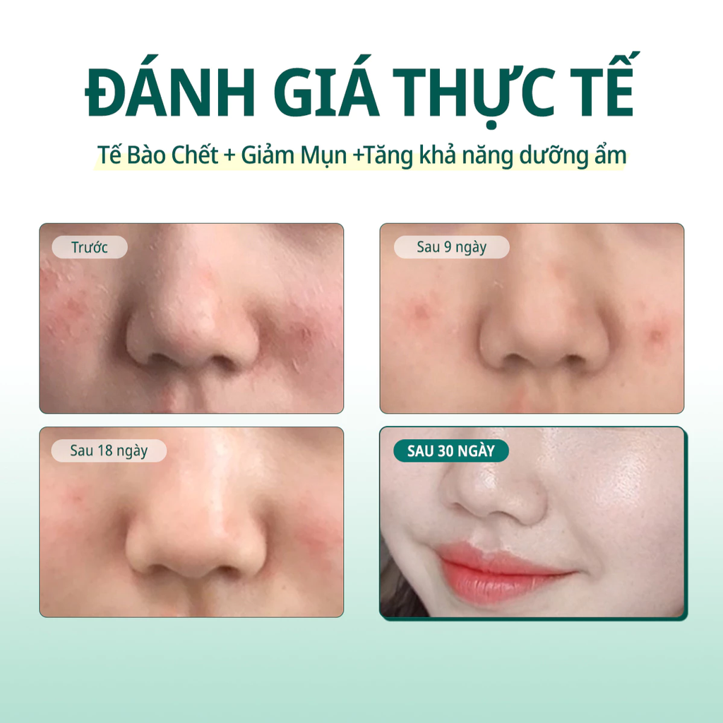 Tinh Chất Trị Mụn Some By Mi AHA-BHA-PHA 30 Days Miracle Serum 50ml