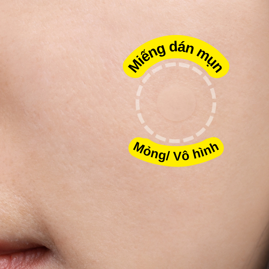 Miếng Dán Mụn Tia'm Hydrocolloid Surprise H Patch 18 Miếng