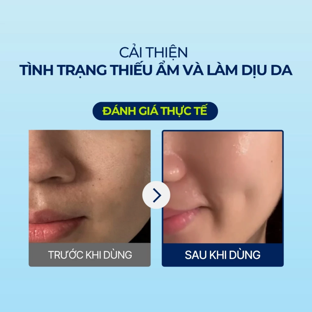 Mặt Nạ Dưỡng Ẩm Làm Dịu Da Torriden Low Molecular Hyaluronic Acid Mask 27ml