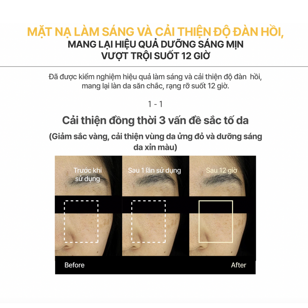 Mặt Nạ Dạng Thạch MediAnswer Nanoshot Mask 37g