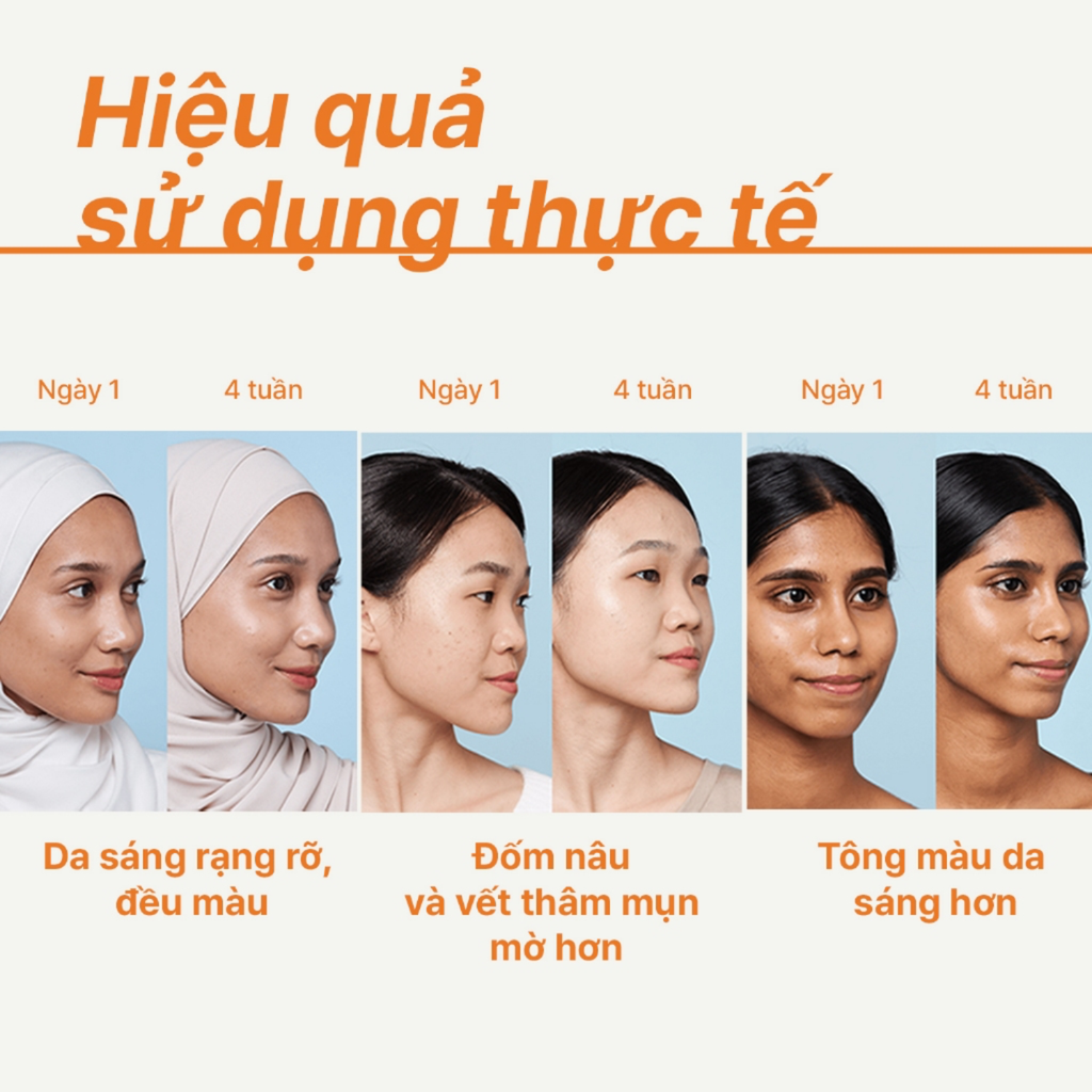 Tinh Chất Dưỡng Sáng Da innisfree Vitamin C Green Tea Enzyme Brightening Serum