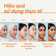 Tinh Chất Dưỡng Sáng Da innisfree Vitamin C Green Tea Enzyme Brightening Serum