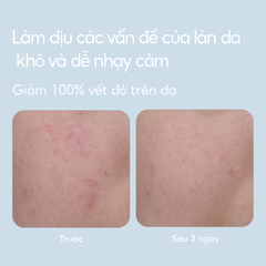 Kem Dưỡng Ẩm Cho Da Dầu Laneige Water Bank Blue Hyaluronic Cream For Combination To Oily Skin 50ml