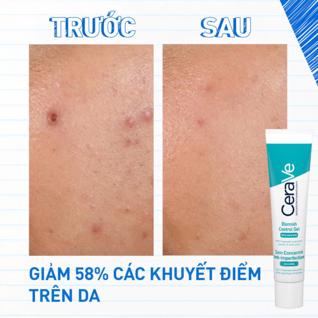 Gel Giảm Mụn Mờ Thâm Thu Nhỏ Lỗ Chân Lông Cerave Blemish Control Gel 40ml