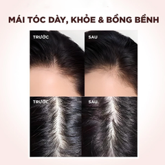 Dầu Gội Giảm Gãy Rụng Tóc Loreal Elseve Full Resist Anti Hair Fall Shampoo 440ml