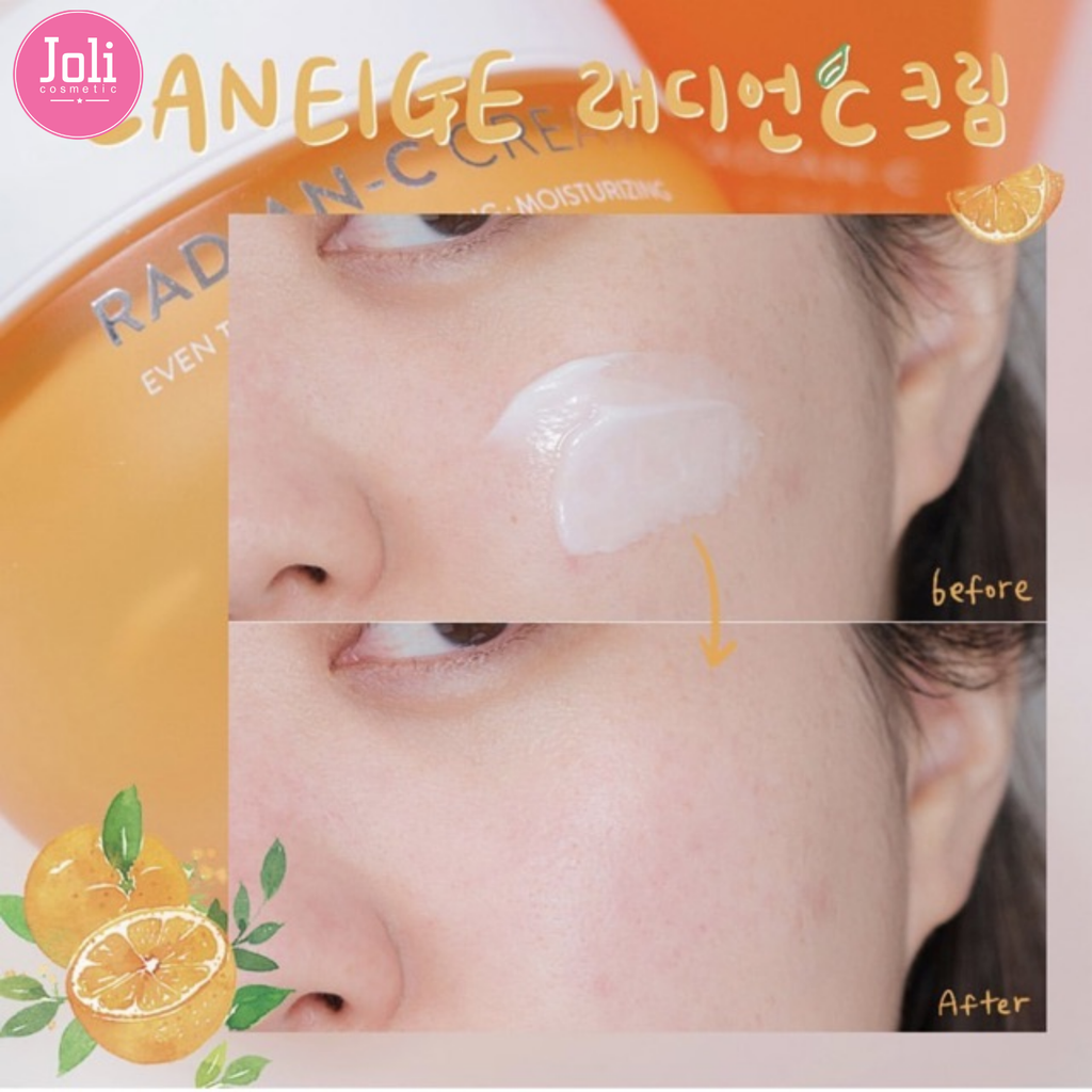 Bộ Kem Dưỡng Trắng Da Làm Mờ Đốm Nâu Laneige Radian-C Cream Collabo Set 30ml